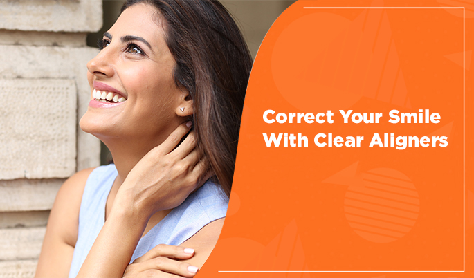 Smile correction with clear aligners
