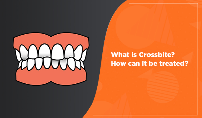 crossbite teeth
