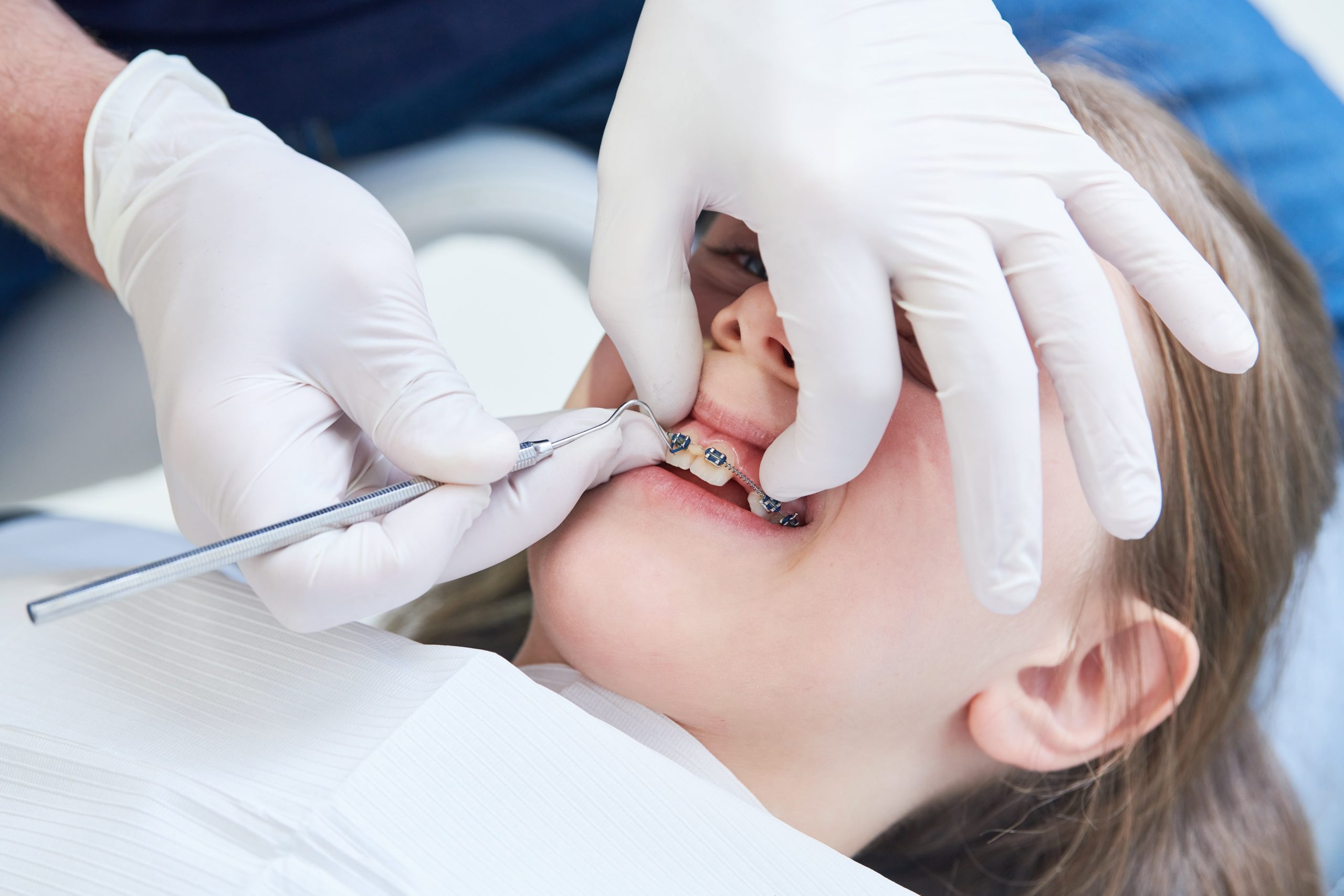 Dentist Vs Orthodontist – What Is the Difference Between Dentist and  Orthodontist?